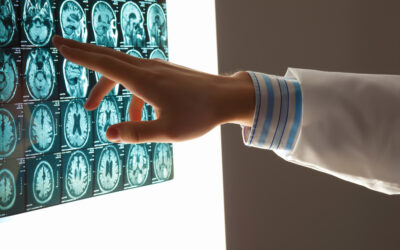 Common Misconceptions About Medical Malpractice Cases